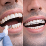 التركيبات الثابتة والمتحركة