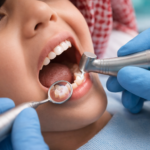 علاج أسنان الاطفال
