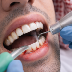 علاج أمراض اللثة