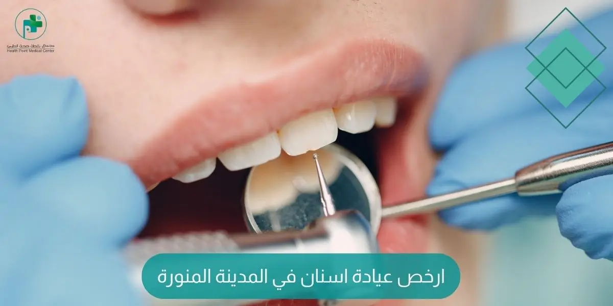 ارخص عيادة اسنان في المدينة المنورة
