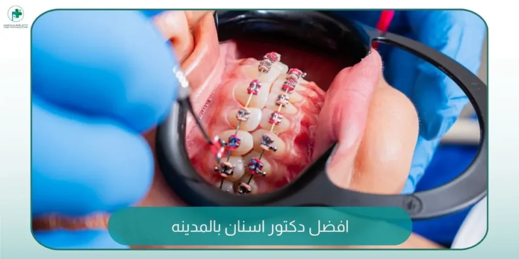 افضل دكتور اسنان بالمدينة المنورة