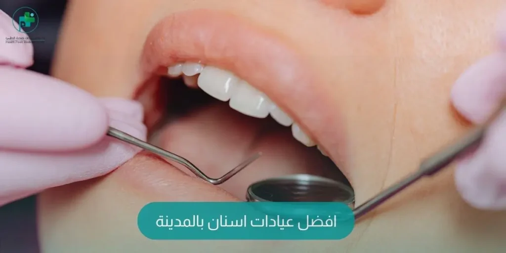 افضل عيادات اسنان بالمدينة