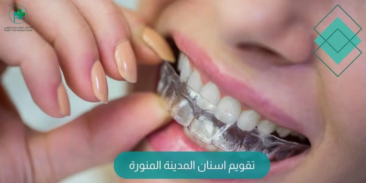تقويم اسنان المدينة المنورة