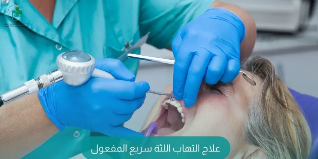 علاج التهاب اللثة سريع المفعول