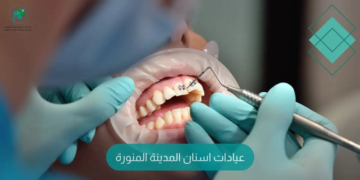 عيادات اسنان المدينة المنورة