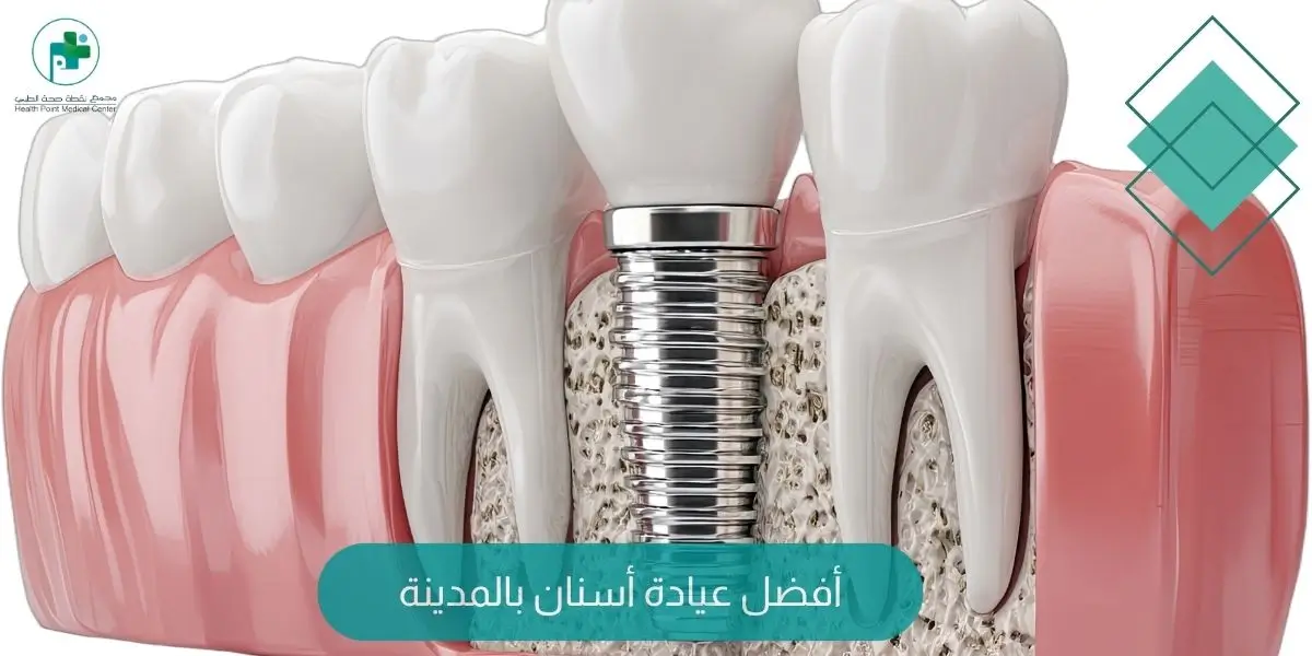 أفضل عيادة أسنان بالمدينة