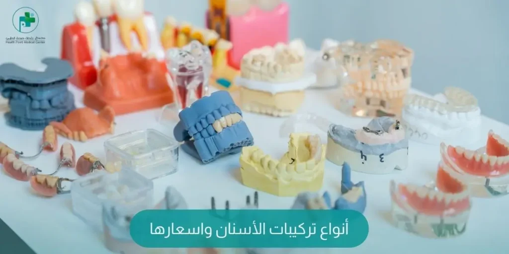 أنواع تركيبات الأسنان واسعارها