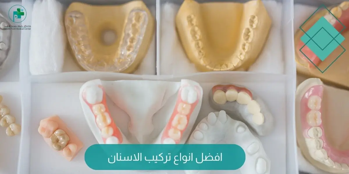 افضل انواع تركيب الاسنان