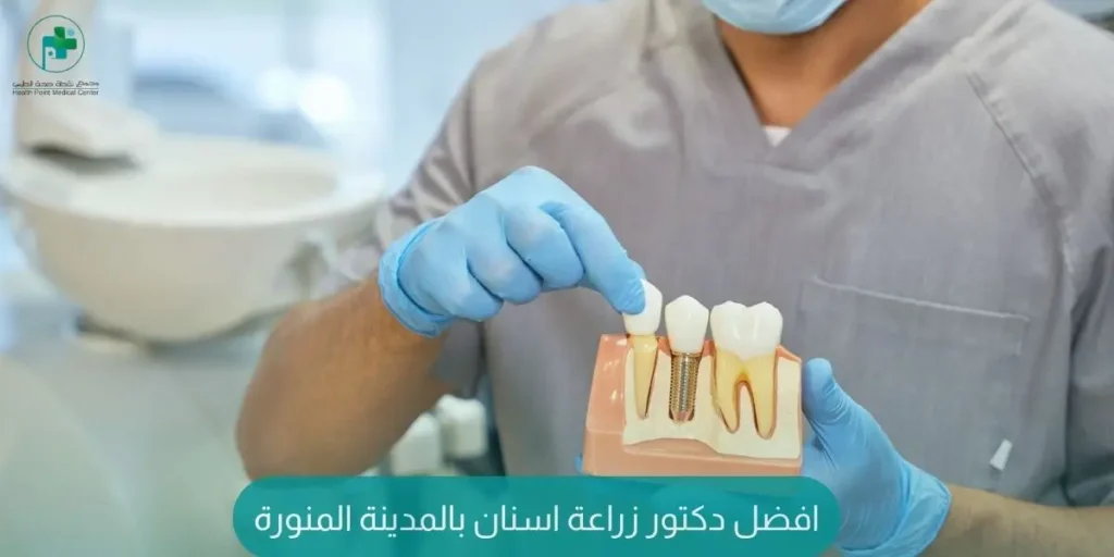 افضل دكتور زراعة اسنان بالمدينة المنورة