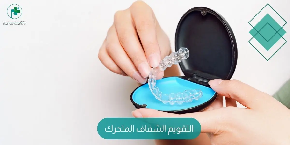 التقويم الشفاف المتحرك