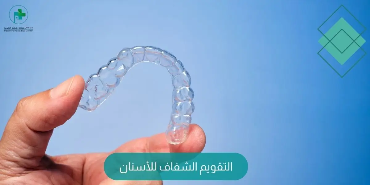 التقويم الشفاف للأسنان