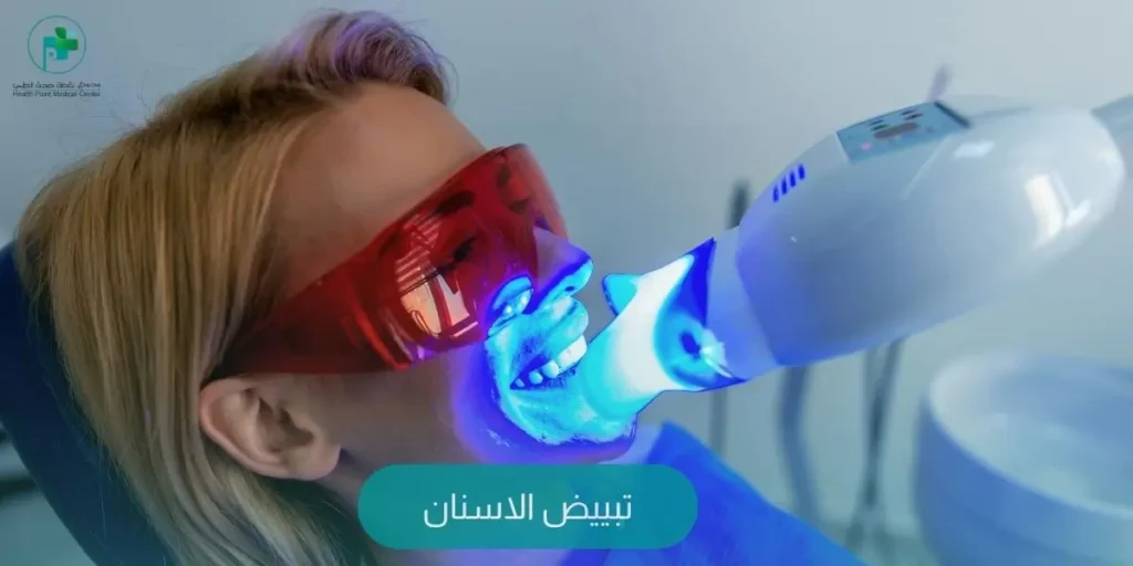 تبييض الاسنان