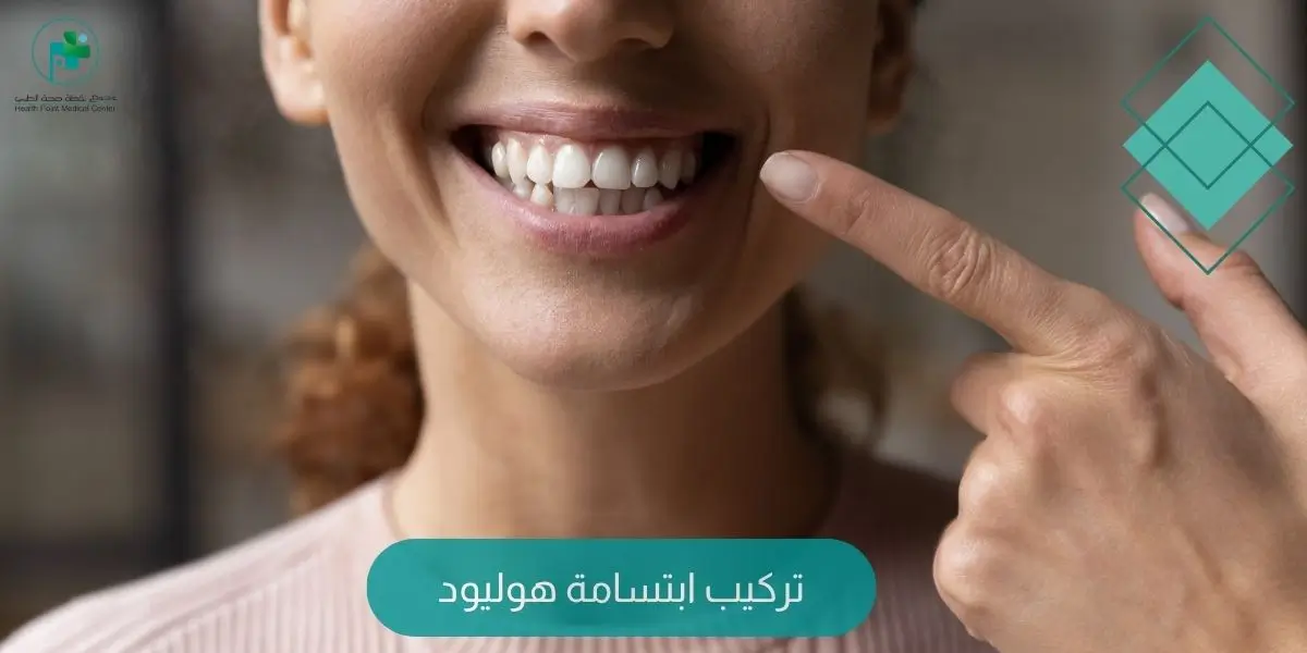تركيب ابتسامة هوليود