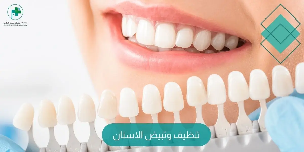 تنظيف وتبيض الاسنان