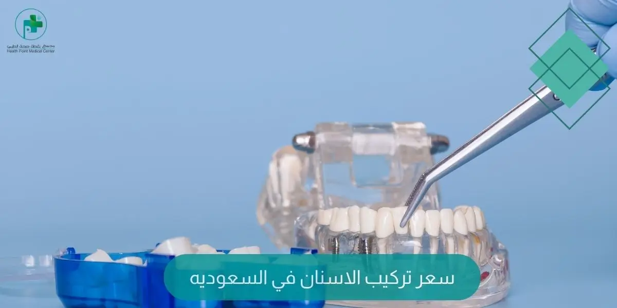 سعر تركيب الاسنان في السعوديه