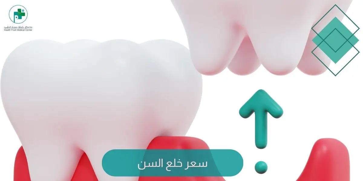 سعر خلع السن