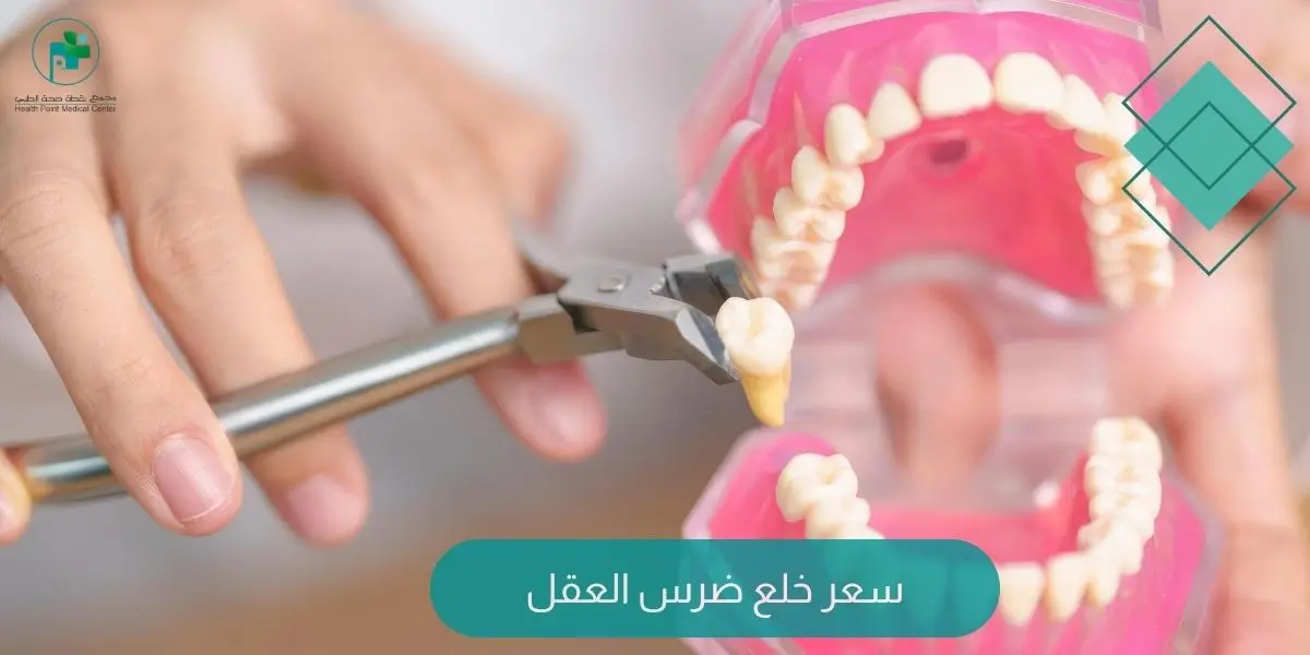 سعر خلع ضرس العقل